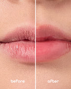 Lip care collection