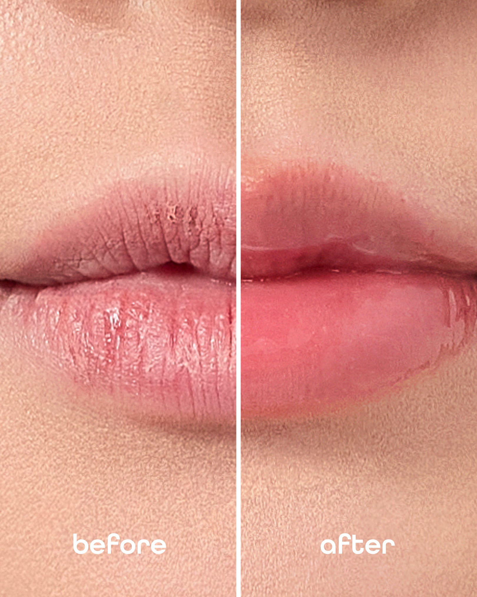 Lip care collection